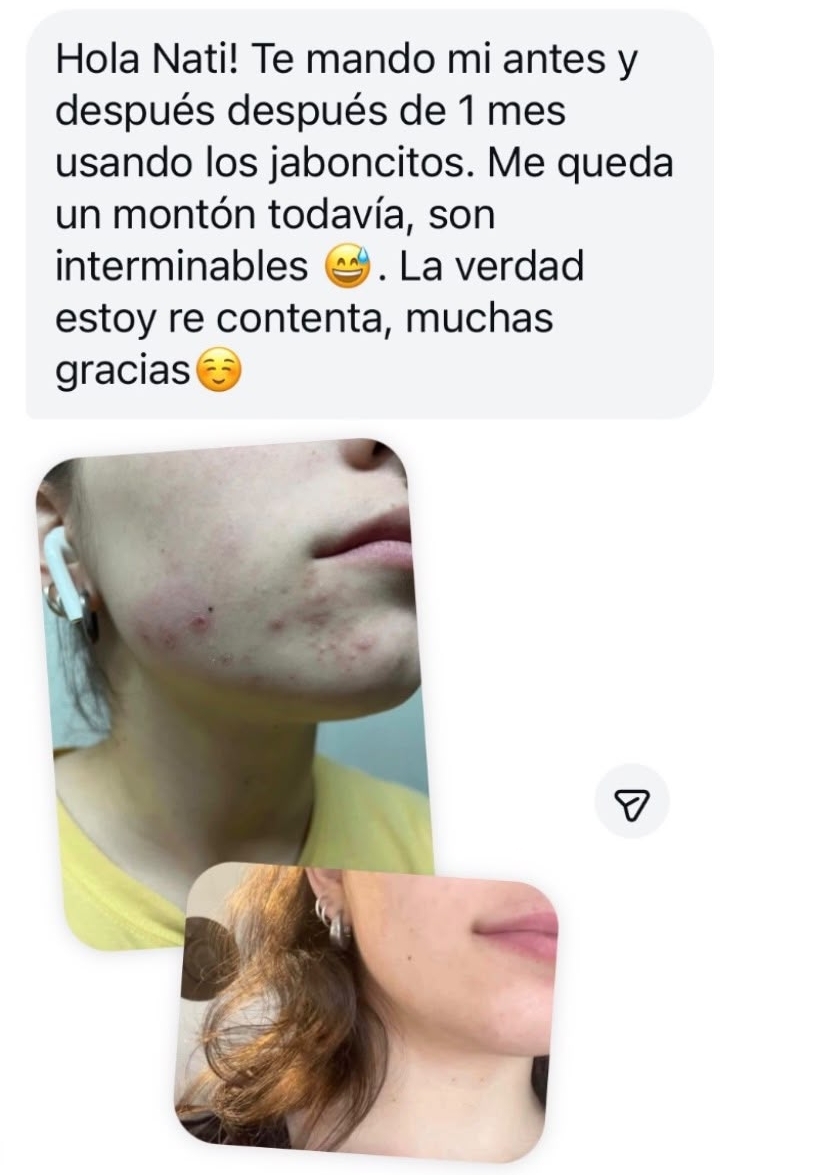 testiomnio cambio piel con productos de narciso artesanal